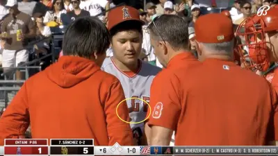 Shohei Ohtani with trainer Mike Fros tad attending to finger injury