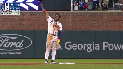 Ronald Acuna Jr holds up his arm