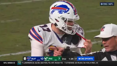 Josh Allen torn collar
