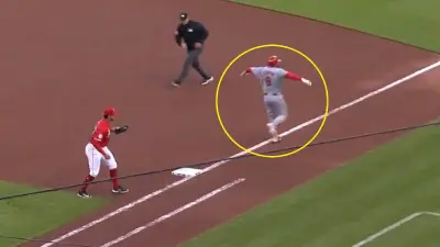 Anthony Rendon hobbling