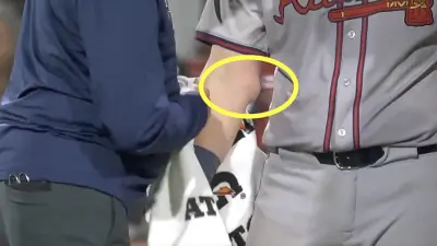 Braves catcher Sean Murphy's swollen elbow