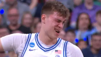 Cooper Flagg with a puffy eye