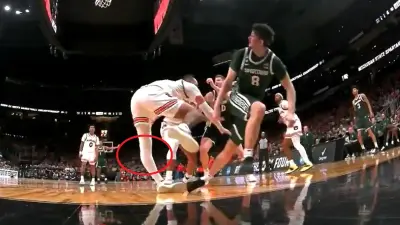 Johni Broome hyperextending his knee