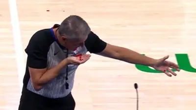 Scott Foster bleeding from his nose